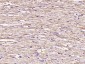 VDAC1 Recombinant Rabbit mAb, Mitochondrial Loading Control